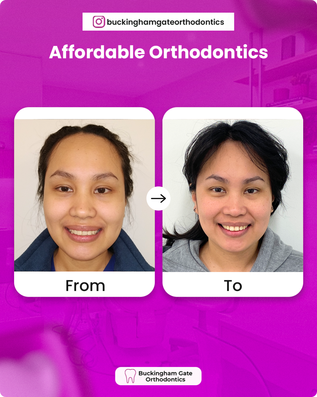 Before_After_01