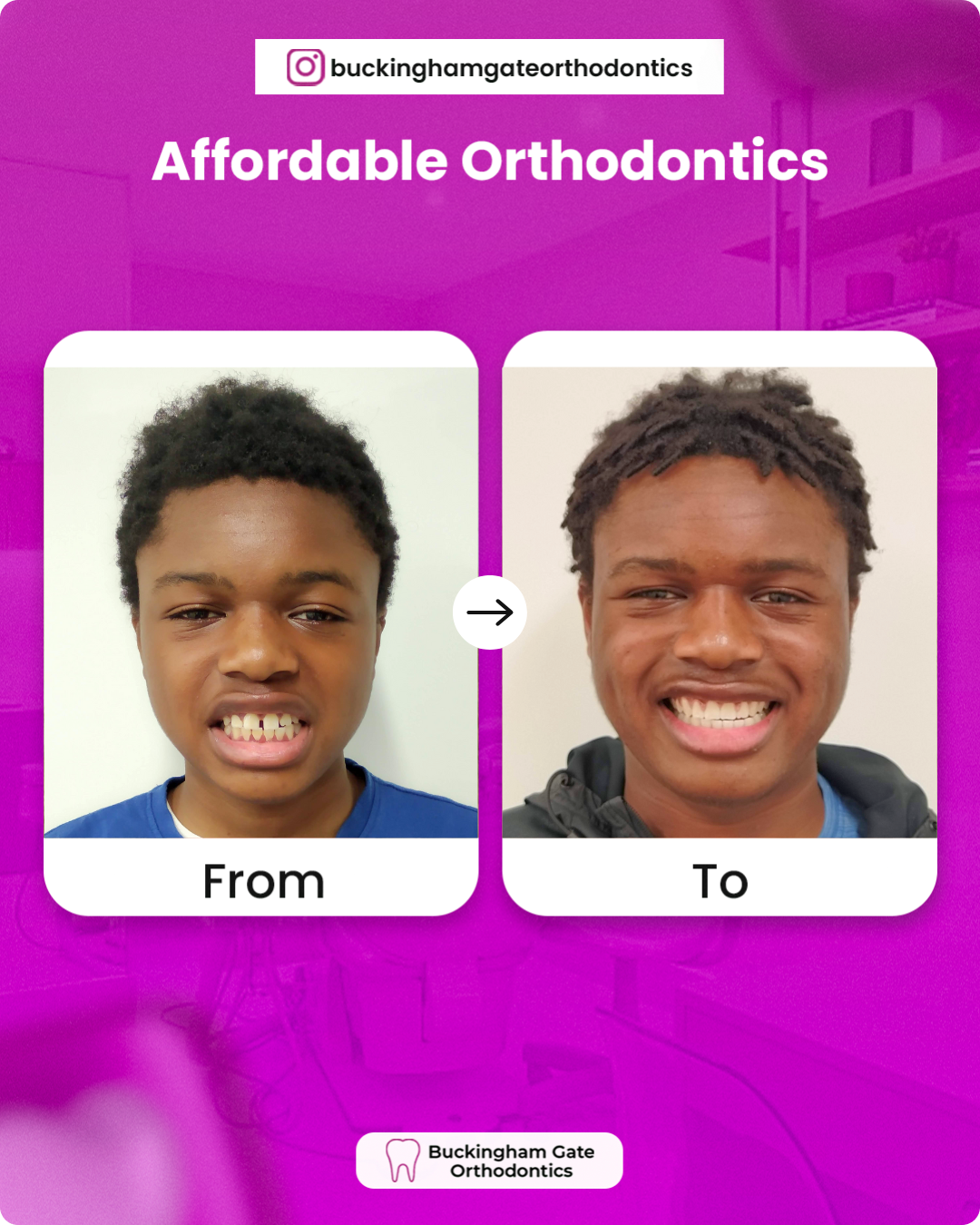 Before_After_04