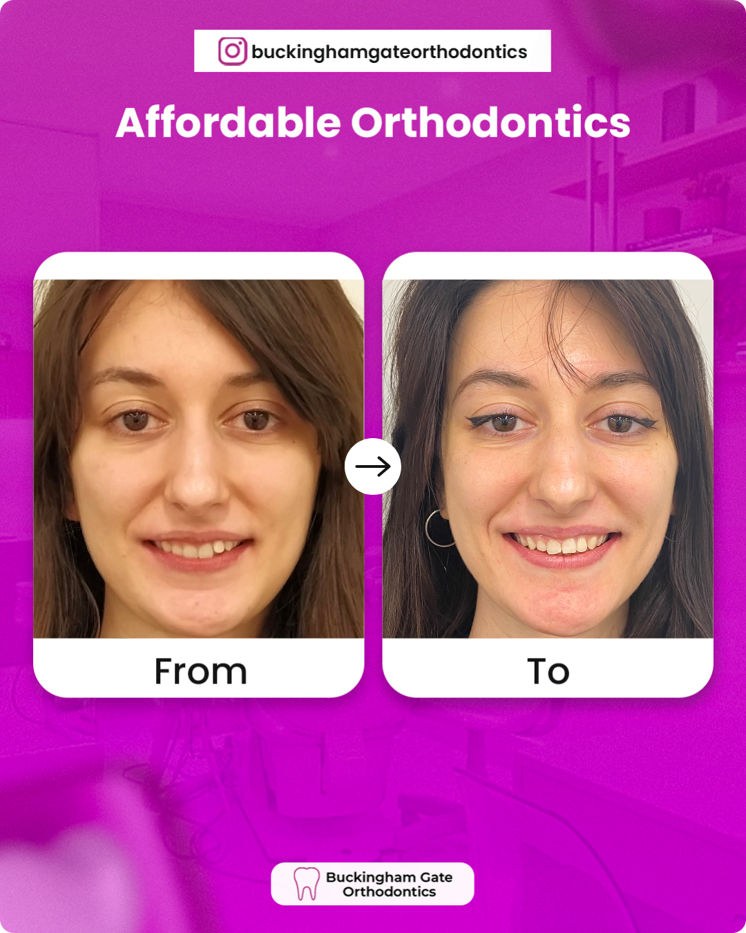 Before_After_07