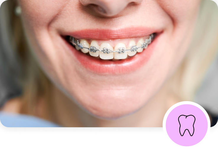 dentist,dentist in london,Buckingham Gate Orthodontics Buckingham Gate Orthodontics 01