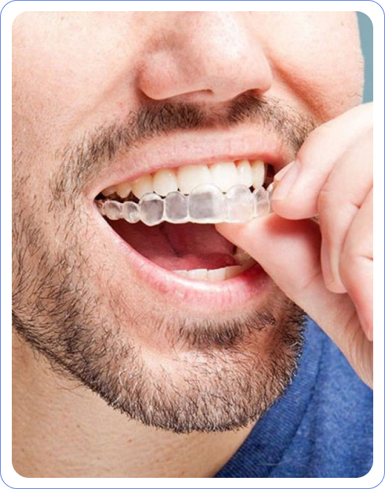 LP Invisalign 1