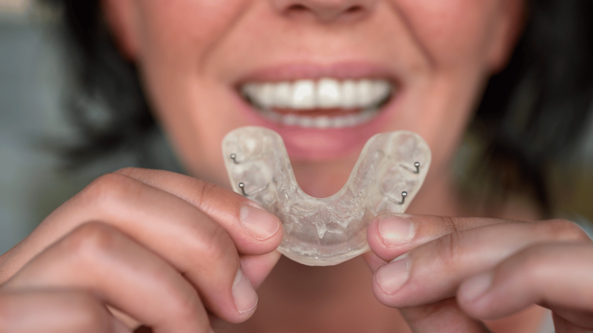 Discover affordable night guards at Buckingham Gate Orthodontics, the top-rated dental clinic in London. Protect your smile today!