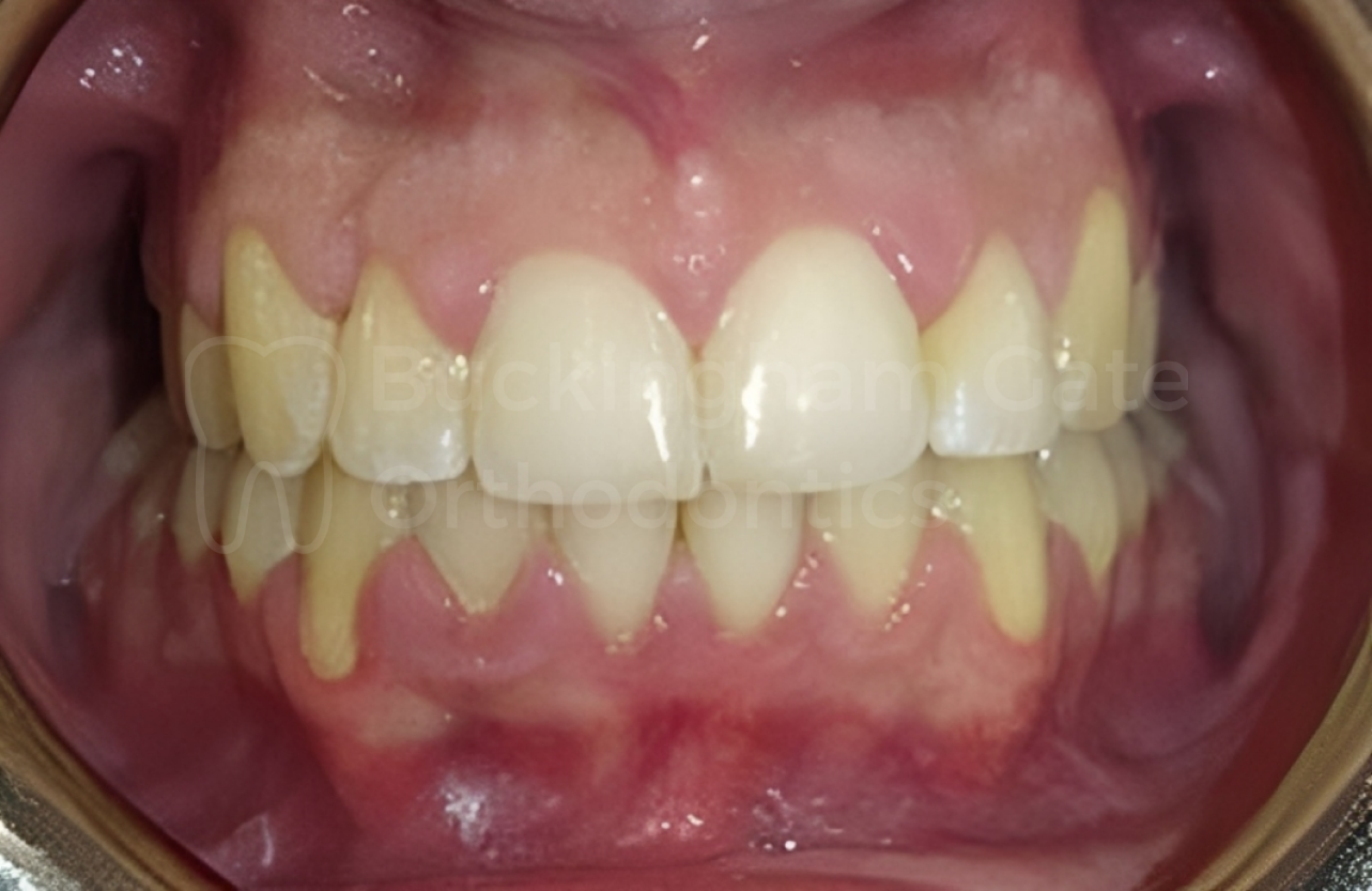 Buckingham Gate Orthodontics