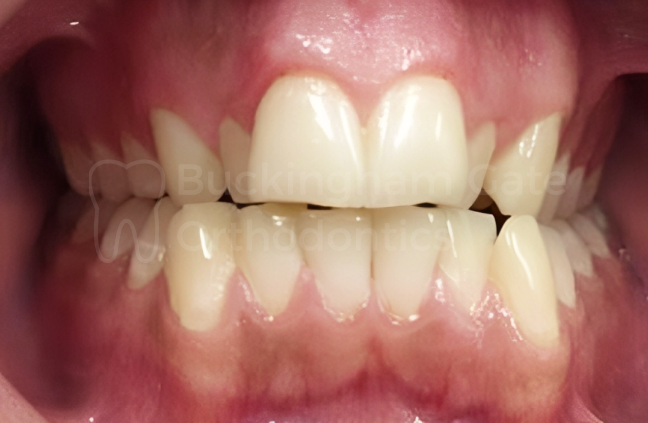 Buckingham Gate Orthodontics