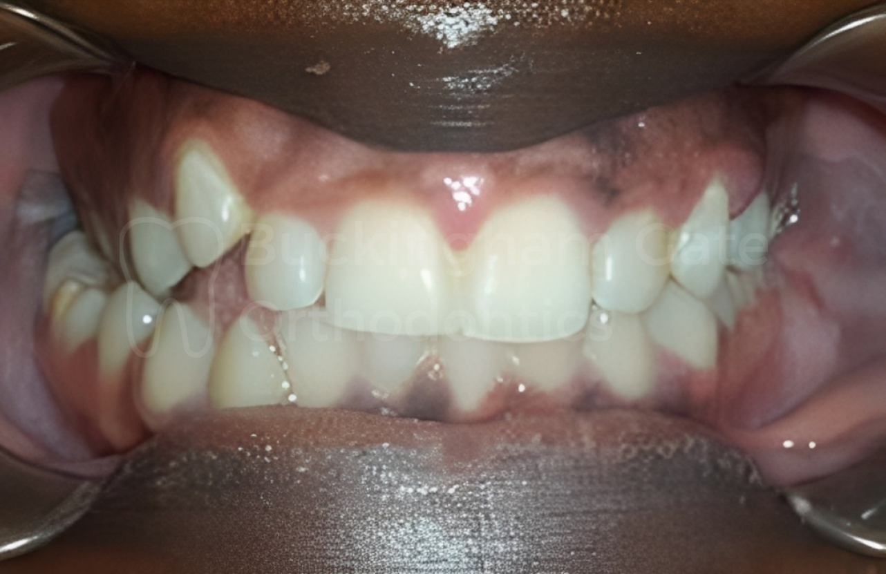 Buckingham Gate Orthodontics