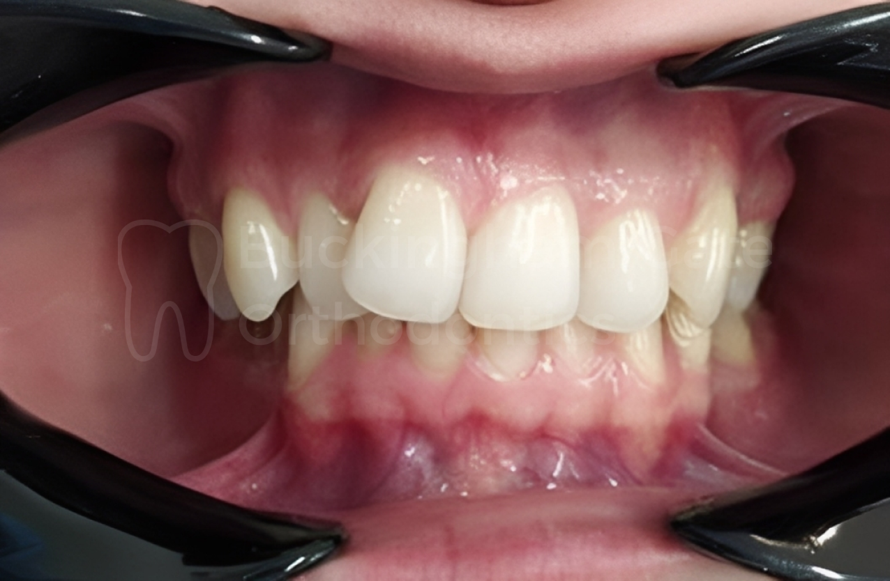 Buckingham Gate Orthodontics