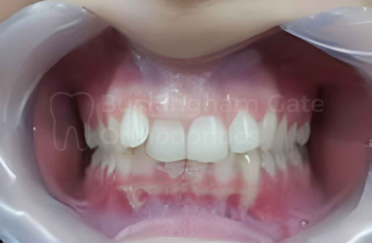 Buckingham Gate Orthodontics