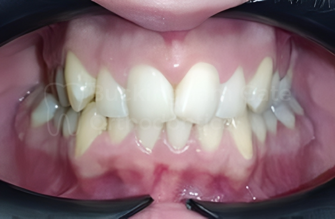 Buckingham Gate Orthodontics