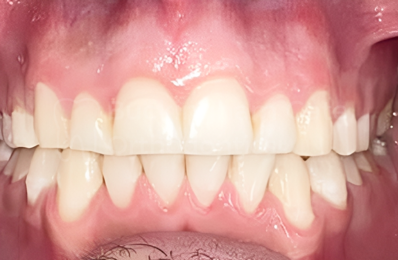 Buckingham Gate Orthodontics