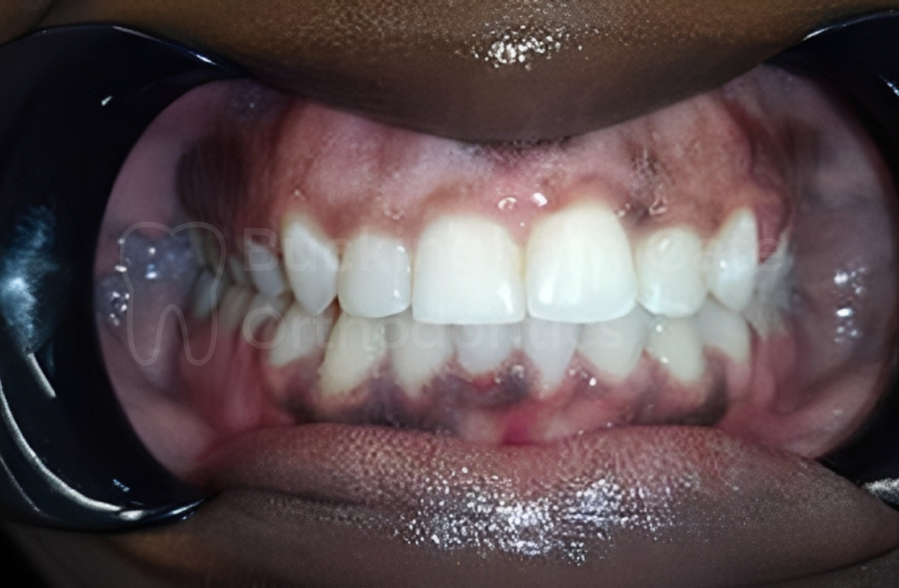 Buckingham Gate Orthodontics