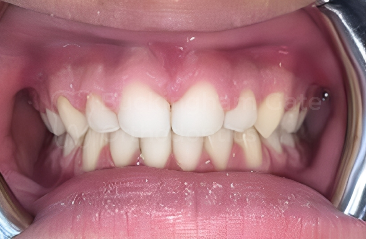 Buckingham Gate Orthodontics