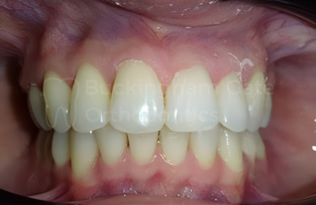 Buckingham Gate Orthodontics