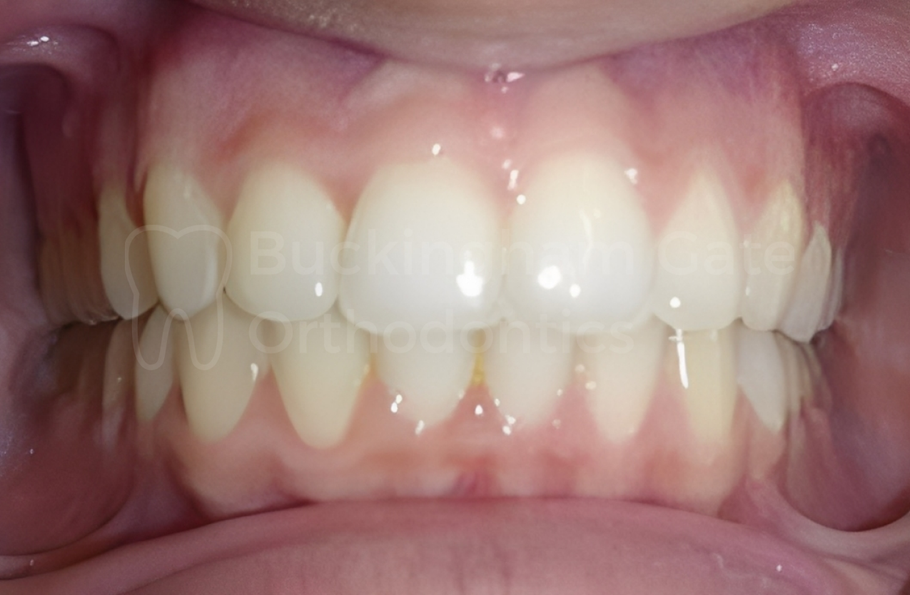 Buckingham Gate Orthodontics