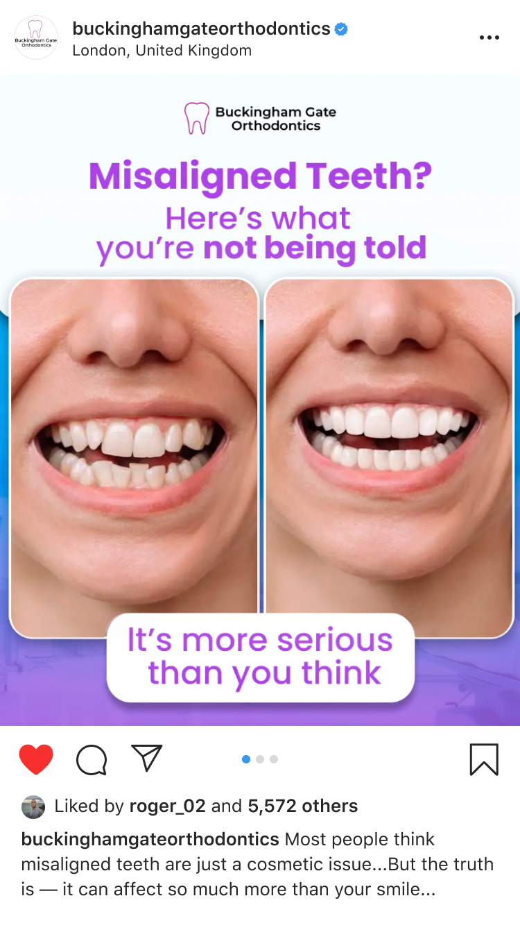 Affordable Braces in London - BGO