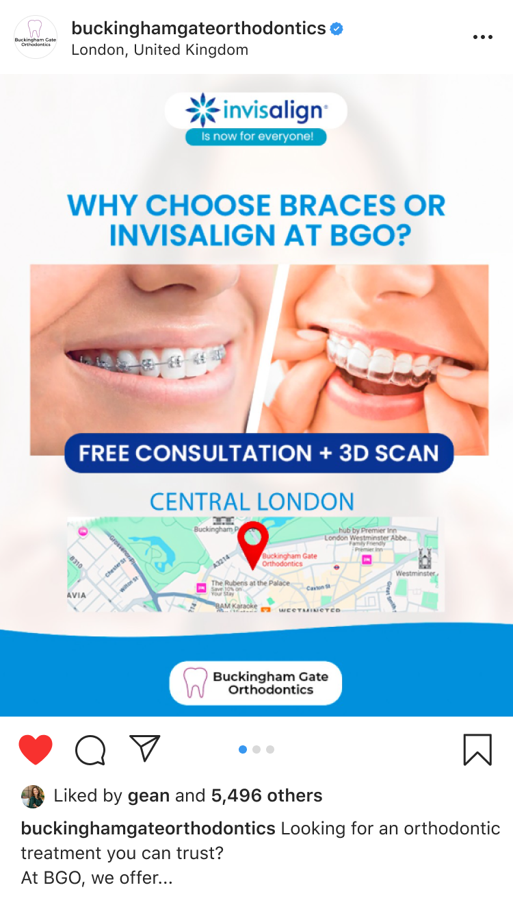 Affordable Braces in London - BGO