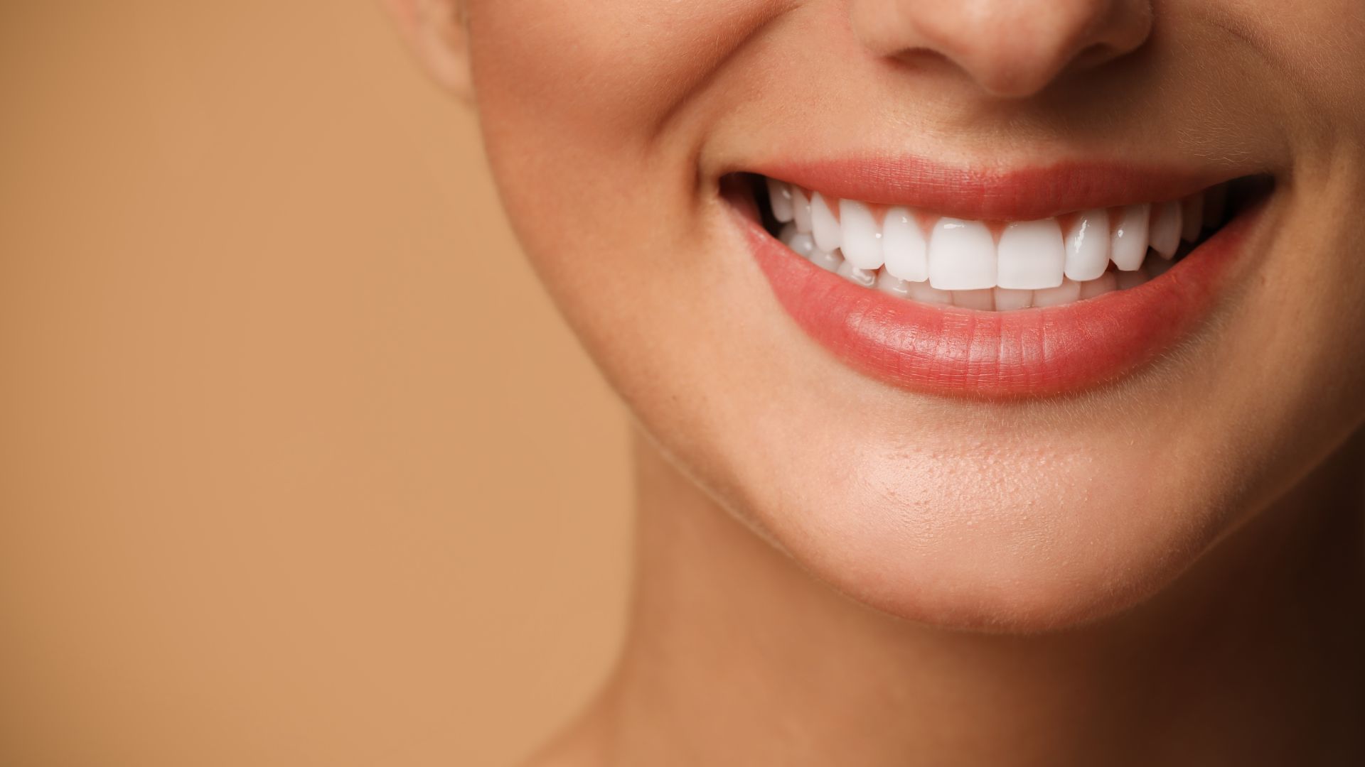 Veneers: The Top Recommended Choice in London