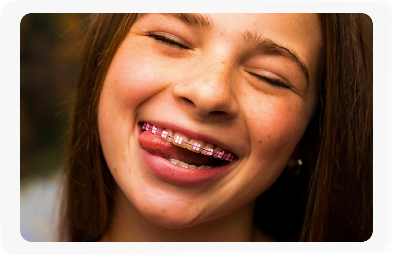 Braces for Children & Teens