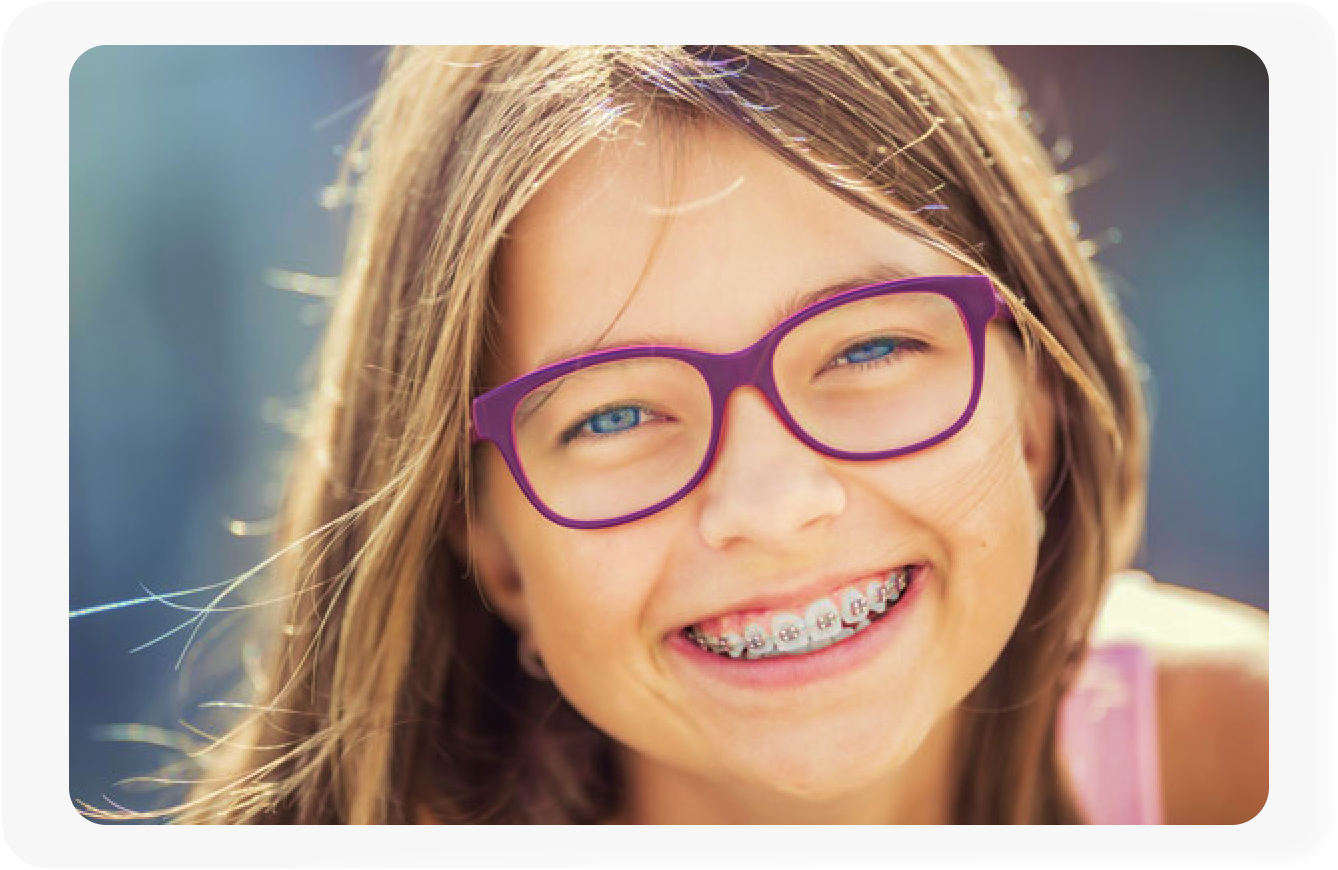 Braces for Children & Teens