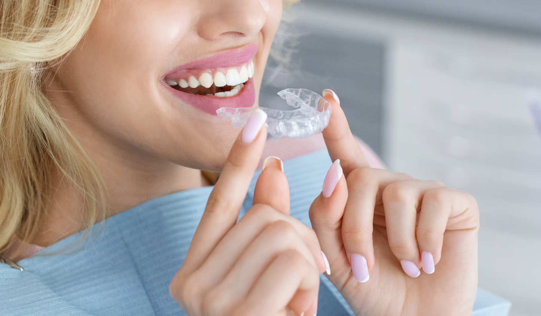 Invisalign in London at Buckingham Gate Orthodontics - V1