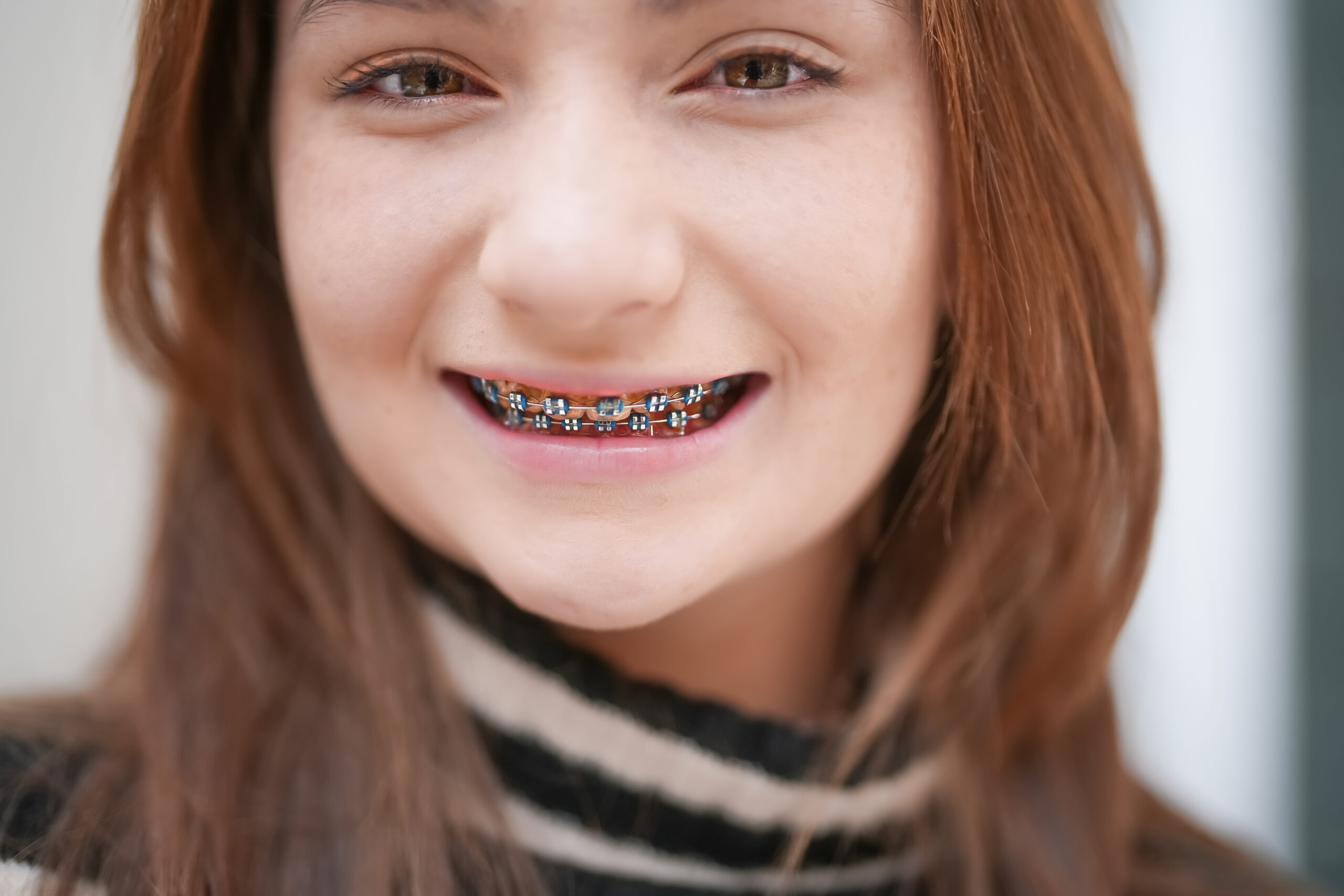 Orthodontics for children