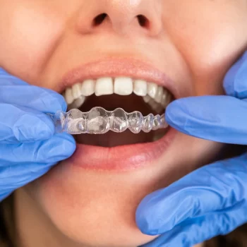 BGO Buckingham Gate Orthodontics - Dentist in London - Invisalign (17)